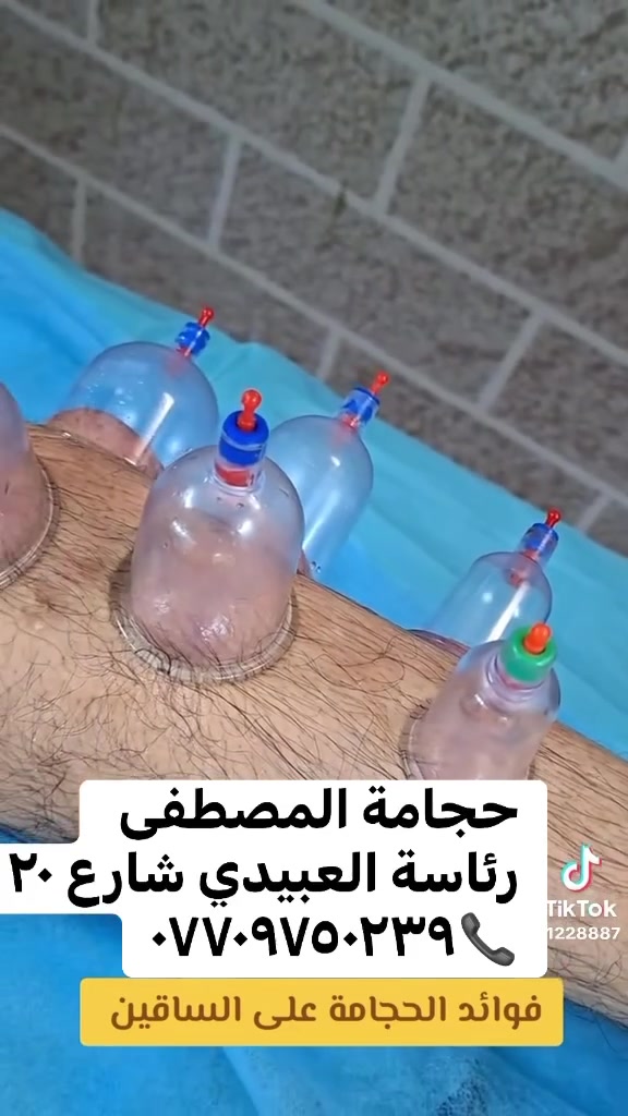 حجامة المصطفى رئاسة العبيدي شارع ٢٠ قرب صيدلية حي الرئاسة مجاور مختبر الأجهر ***********@
