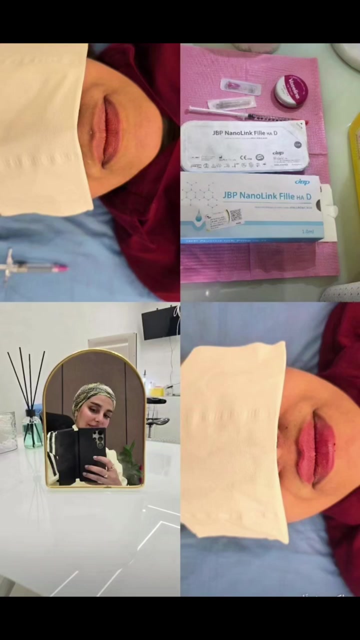 فيلر ١ سي سي • مسجل وزارة الصحة • بسماية