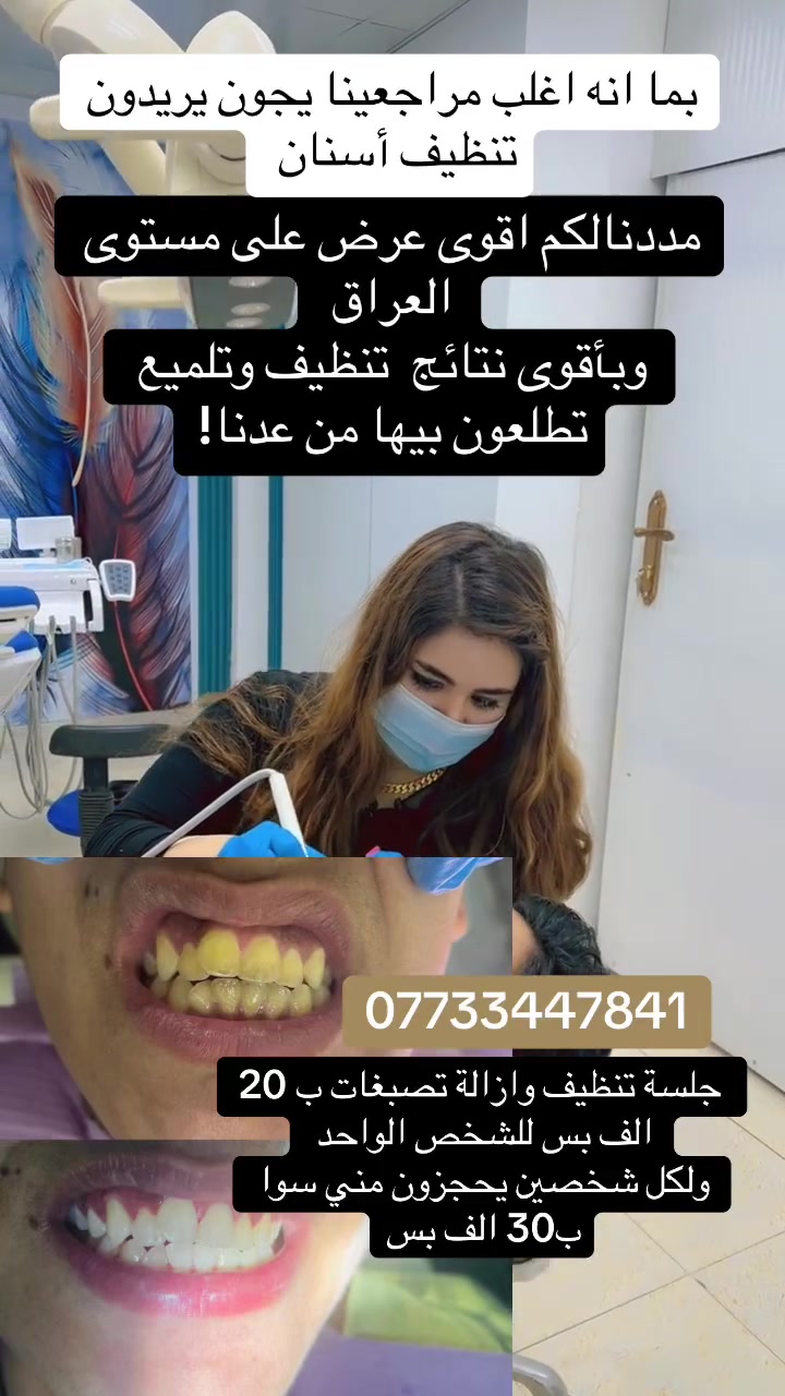 تنظيف اسنان • عرض لشخصين • حجز موعد