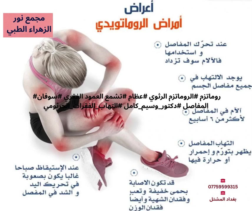 💛أعراض أمراض الروماتيدي!!!!!!!!!!!!!
#المفاصل#الروماتيدي
@متابعين@أبرز المعجبين@الجميع
