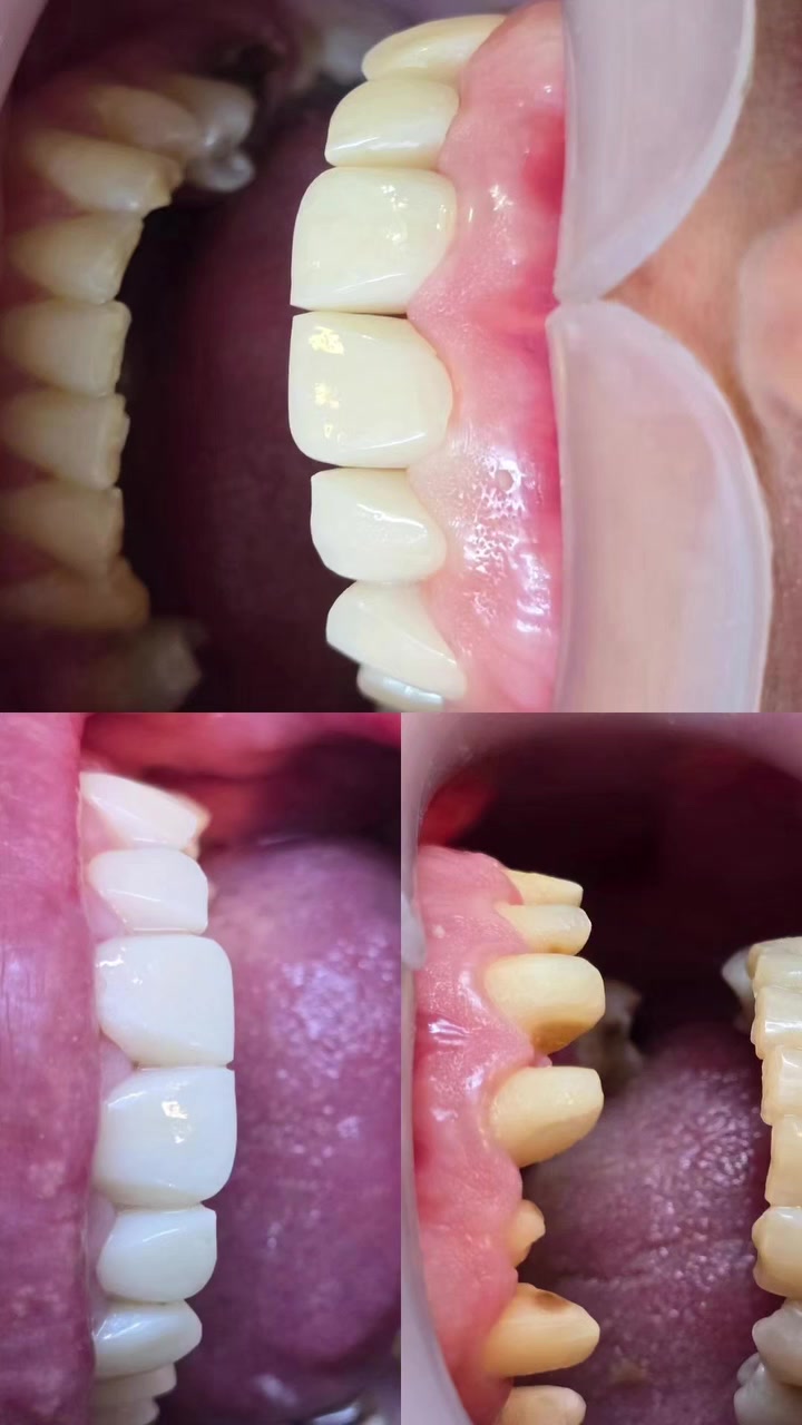 ابتسامة اسنان • تجميل اسنان • تبيض