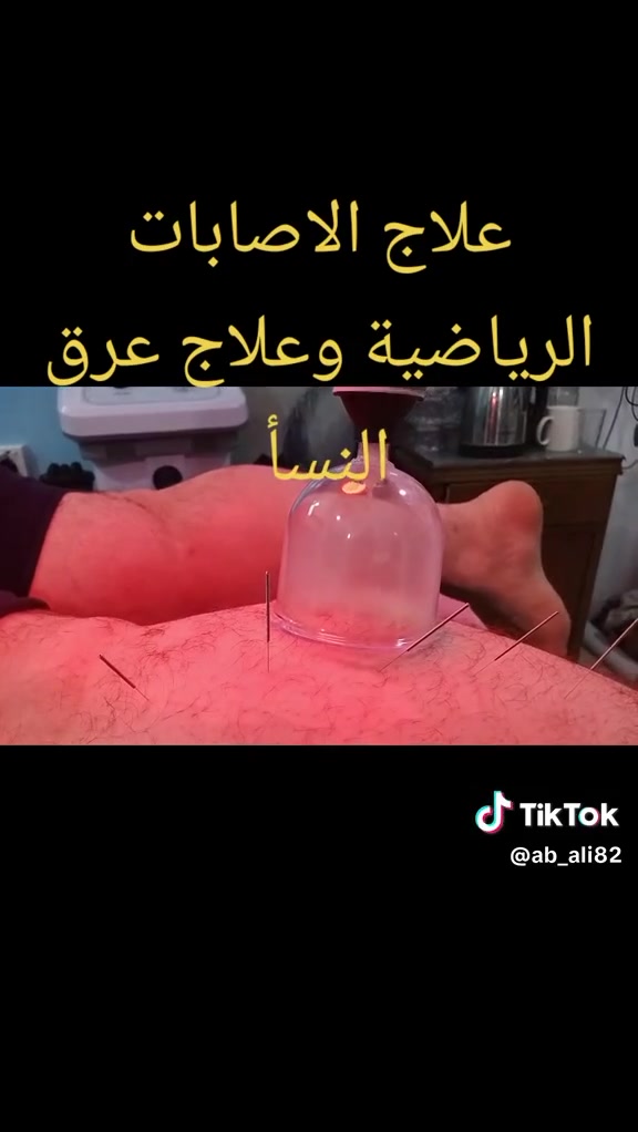 عيادة دار الشفاء للحجامة والعلاج الطبيعي علاج الانزلاق الغضروفي للفقرات وعلاج عرق النسأ وعلاج الوثاب وعلاج الجيوب الانفية والحجامة باانواعهه العلاجية والوقائية والنبوية ***********
