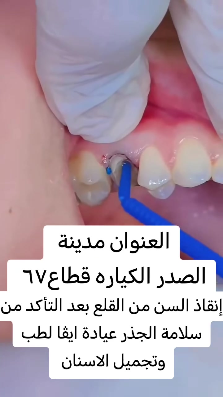 الكياره قطاع67 • عيادة ايفا • د.محمد سعدون