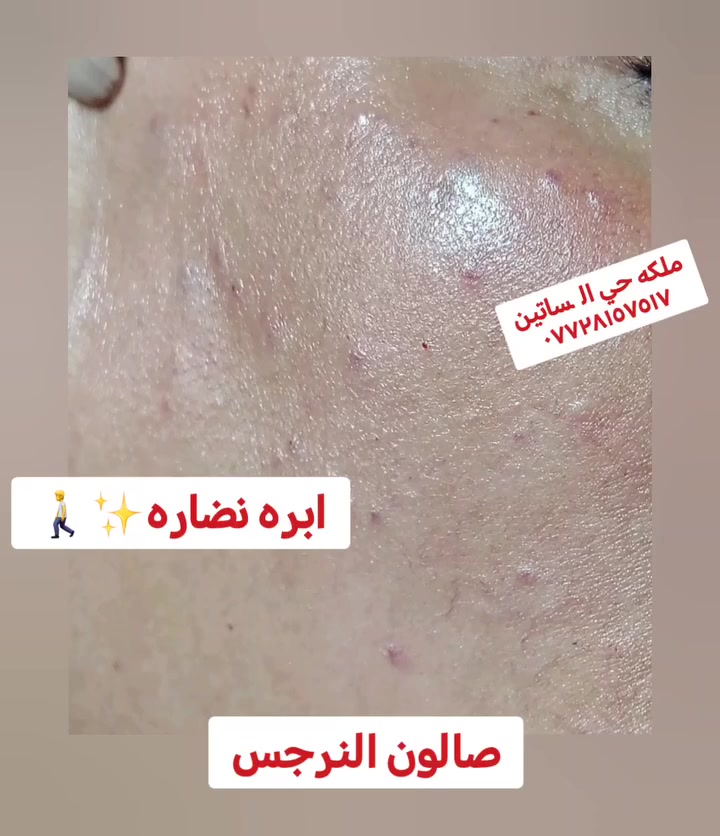 صالون النرجس حفافه ب٥ تنضيف بشره ب٥ معالج للشعر ب١٠ شعر قصير طويل ب١٥ شمع ب٥ قص شعر ب٥شسوار ب٥ درمابن ب٥ ابره نضاره ب١٠ تنضيف قدم ملكي ب١٠ تنضيف عادي ب٥ عنوان حي البساتين @

نص مكتوب في الصور:
- ملكه حي البساتين *********** صالون النرجس