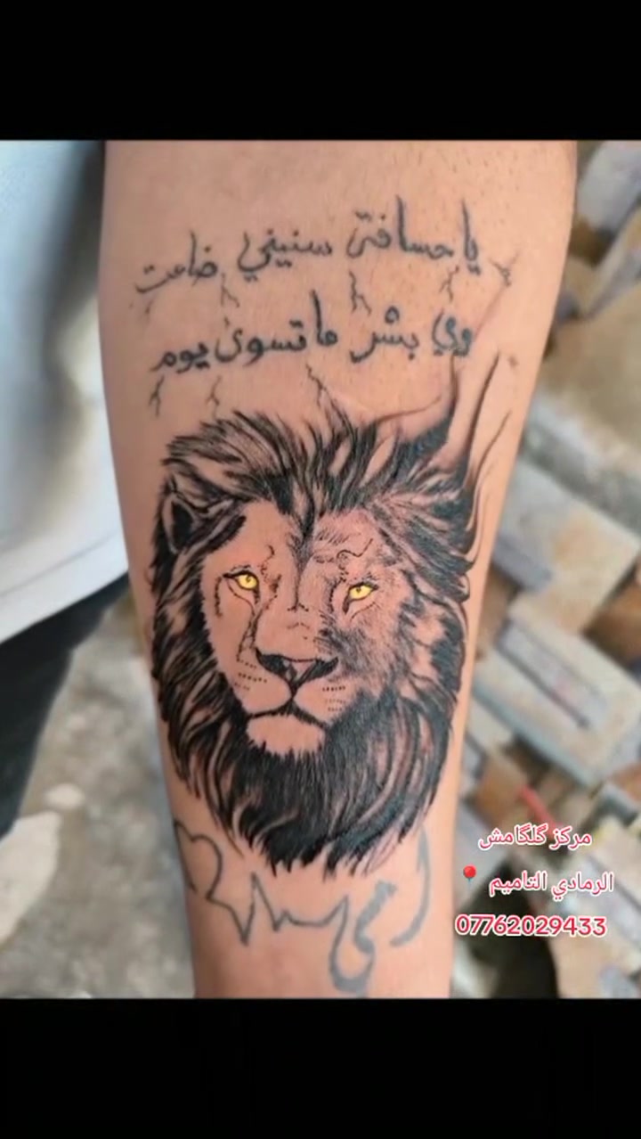 مركز گلگامش • ازالة وشم • الرمادي التاميم