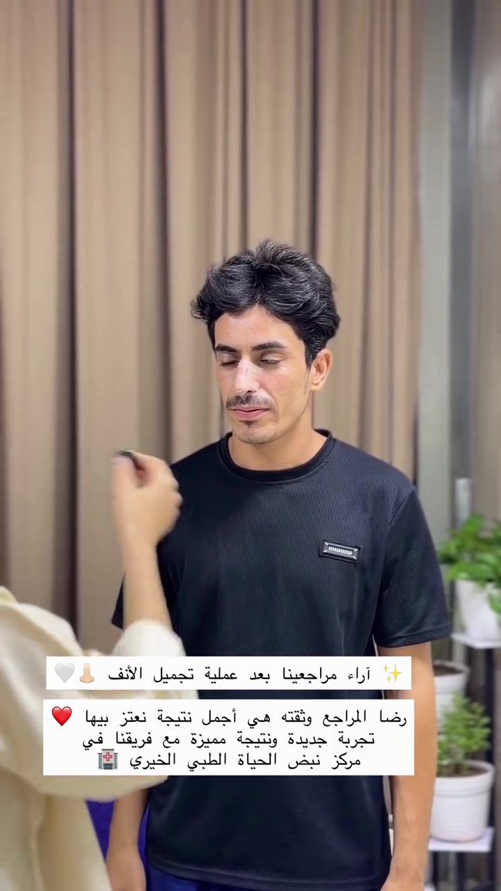 ✨ آراء مراجعينا بعد عملية تجميل الأنف 👃🏻🤍

رضا المراجع وثقته هي أجمل نتيجة نعتز بيها ❤️
تجربة جديدة ونتيجة مميزة مع فريقنا في
مركز نبض الحياة الطبي الخيري 🏥

👨‍⚕️ د. شادي أبو ملحم
اختصاص علاج وجراحة أمراض الأنف والأذن والحنجرة:
🔹 الجيوب الأنفية
🔹 الزوائد الأنفية
🔹 التهابات الأذن الوسطى
🔹 ترقيع طبلة الأذن
🔹 علاج الدوخة والحساسية

✨ تجميل الوجه الجراحي:
▪️ تجميل الأنف
▪️ تصحيح بروز الأذن
▪️ قص الجفون
▪️ رفع الحاجب
▪️ رفع وقلب الشفة

🏥 مركز نبض الحياة الطبي الخيري

🕘 أوقات الدوام:
🔹 الشفت الصباحي: 9:00 صباحاً – 12:00 ظهراً
🔹 الشفت المسائي: 3:00 عصراً – 10:00 مساءً

📍 العنوان:
العراق – الناصرية
فلكة السماوة، مقابل مطعم حياوي، مجاور أسواق الشامية.

📞 للحجز والاستفسار:
***********

#تجميل_الأنف #قبل_وبعد #د_شادي_أبو_ملحم #الناصرية #نبض_الحياة العراق fyp fypシ ترند
