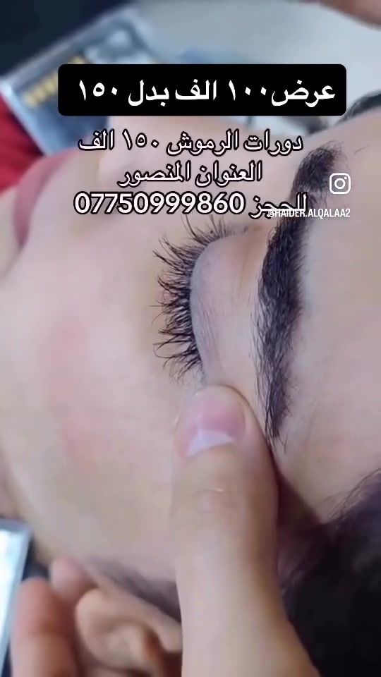 لا توجد تفاصيل
