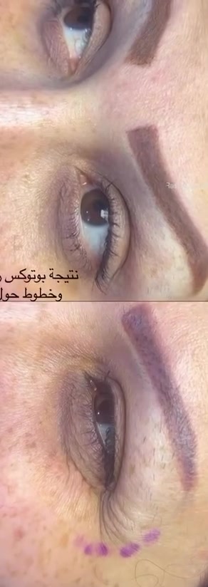 مركز ليان بيوتي اربع شوارع مجاور ازياء بسام القريشي عرض سيسي 50 
للحجز ***********
