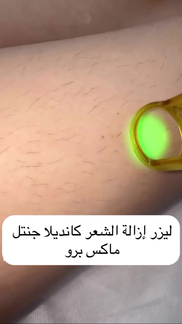 تم بحمد الله 
ومثل ماوعدتكم 
وصول الجوووكر 
الجهاز الي بدون الم 
الجوكر يعني يرهم على كل الاجهزة بدون تحفيز
يعني لو مسوية باي جهاز يرهم حتى لو واصلة ادامة 
الاكسندرايت يعني يرهم للبشرة البيضاء والسمراء حتى الافريقي 
4 جلسات او 5 يوصل ادامة 
نتائج فورية وبضمان 
من مجمع ماس الطبي 

هلو حبايبي هواية تسالون عالجهاز الجديد 
وصل وصل حبايبي 
جنتل مكس برو 2026
من المصنع الى مجمع ماس الطبي
نظام الكسندرايت اندياك 
 
يعمل بنظام التبريد بواسطة الزمر الخارجية وغاز النتروجين 
جميع انواع الشعر عدا الشعر الاشيب 
يسخدم حتى للبشرة الافريقية والاماكن العنيدة الصعب ازالة الشعر منهة 
للاسعار
وجه 20 
اندر 20 
بكيني 20 
3 مناطق ب50
نصف ايد 30 
نصف ساق 30 
ايد مع اندر 50 
ساق 50 
ساق مع بكيني 60
مني بدي 80 
فول بدي 100 
توتل بدي 125

كل 4 بيشنت ال5 مجاني 
العنوان المجمع الترفيهي @مجمع ماس الطبي 
مقابل مول بسماية 
للحجز والاستفسار ***********
 ا@إشارة

نص مكتوب في الصور:
- 11:50
- حبايبي بسمايا
- عضو مجهول الهوية - 23 س
- 2 س أَعجبني
- رد
- عضو مجهول الهوية - كاتب
- 19 س أَعجبني
- InspiringParrot1084 - الكنية
- 23 س أَعجبني
- Hadeel Raad - مساهم ممتاز
- ليان للليزر والتجميل
- Senyorita Senyorita - مساهم ممتاز
- عطر النرجس - مساهم ممتاز
- كريم الخفاجي - مساهم بارز
- 3 س أَعجبني
- اكتب تعليقا...
- حبايب بسمايا
- عضو مجهول الهوية 1 ي
- Banen Nasir
- مساهم ممتاز
- عن تجربه ليان لليزر والتجميل
- 12 د
- أعجبني
- اكتب ردًّا...
- جنه الفردوس جنه الفردوس
- ليان لليزر والتجميل يخبل
- 5 س
- فيونكه ستور
- ليان لليزر والتجميل بالليزر واحد بسمايه
- 8 س
- Habah Vian
- حنين بيوتي اكيد حنونه اهل بسمايه
- الإثنين
- أم حيدوري
- اكيد بدون تفكير ليان لليزر والتجميل ماكو احسن منها
- 3 س
- Zahraa Hussein
- اني جربت النضارة يم ام ليان ليان لليزر والتجميل
- 6 س
- Rasha AL Hachim
- مساهم صاعد
- ام ليان لليزر والتجميل الاولى والافضل عن تجربه مراح تعبين
- 4 س
- اكتب تعليقًا...