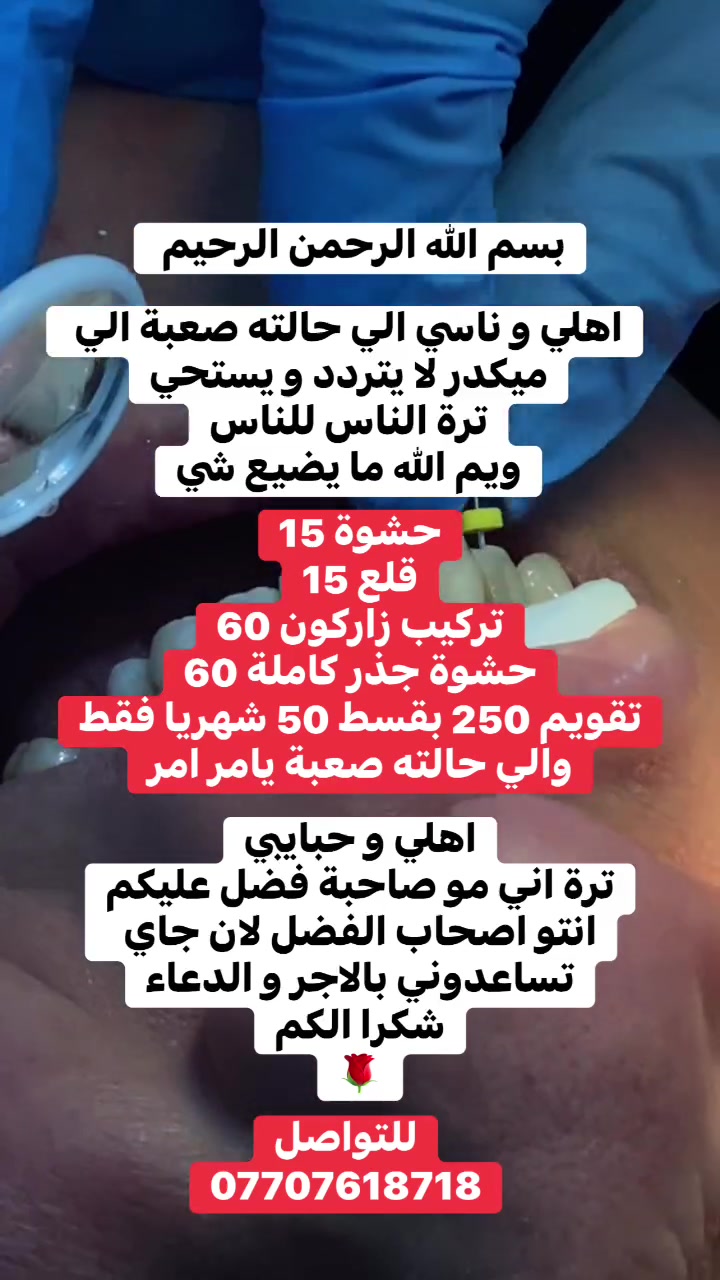 امهاتي و خواتي 
اخواني و ابائي 
اني ابنتكم و اني بالخدمة الله شاهد  
راسل الرقم و تدلل
.
.
.
.
.
.
.
.
.
.
.
. 
 #اسنان #عيادة #بغداد
