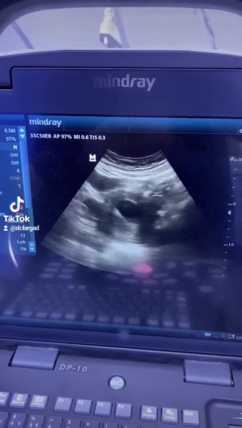 ✨ تتواجد اليوم بمراجعة ٥ الاف فقط تشمل السونار ✨
🌸 الدكتورة رنا الحبوس 
🩺 نسائية / رعاية حوامل / فحص بالسونار
📍 النهروان – سوق الأولى _ قرب شارع ٦٠ 
مجمع العون الطبي
📞 للحجز والاستفسار
***********
🤍 أهلاً وسهلاً بكم
#النهروان #الشمري #شارع_المواكب #سوق

نص مكتوب في الصور:
- مجمع العون الطبي بشرى سارة لاهالي نهروان والعوائل المتعففة ان يوم السبت سوف تكون اجور المعاينة ( الكشفية ) خمس الاف فقط الدكتورة رنا الحبوس رعاية... حوامل... نسائية... توليد في مستشفى بغداد التعليمي مدينة الطب صحتك... مستقبل آمن @dr.fargad علما الدكتورة تتواجد من ٣ إلى ٧ مساءأ والحجز مفتوح من الان
- الدكتورة الاختصاص رنا الحبوس نسائية توليد رعاية حوامل عقم عمليات نسائية و ولادة @dr.fargad فحص بالسونار الدوبلر الملون AI-generated
- الدكتورة الاختصاص رنا الحبوس نسائية توليد رعاية حوامل عقم عمليات نسائية و ولادة فحص بالسونار الدوبلر الملون dr.fargad Al-generated