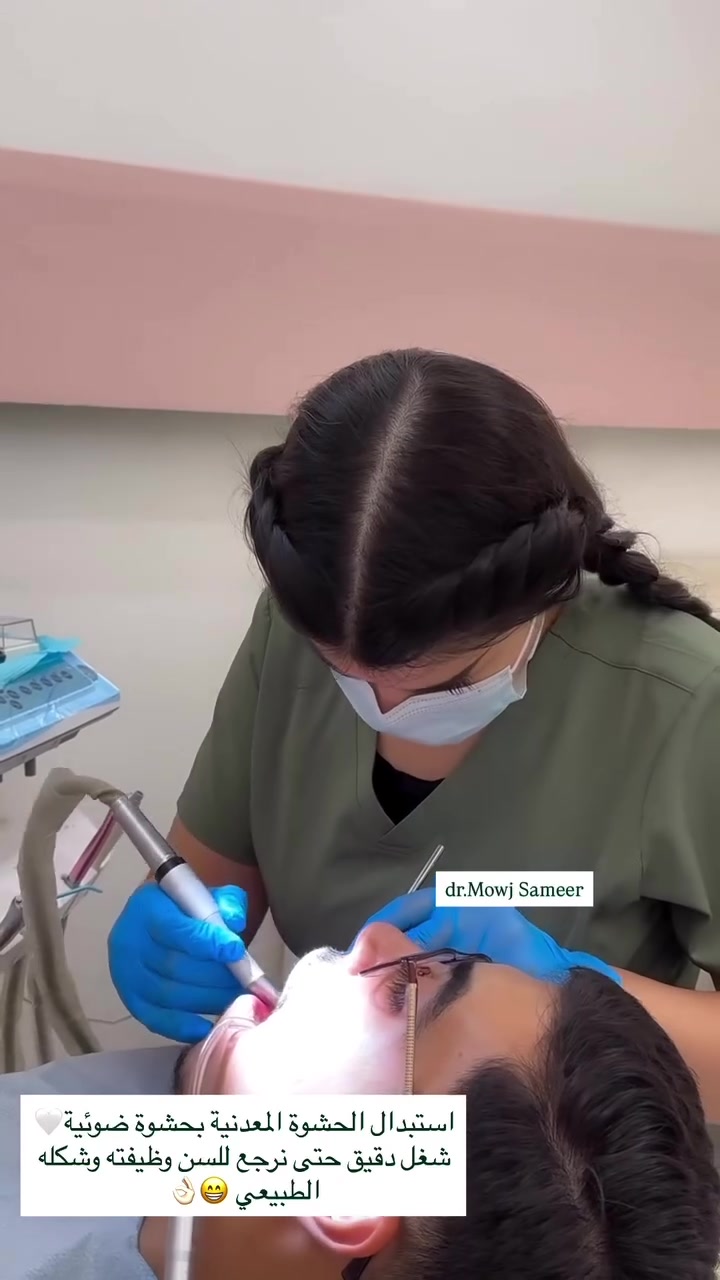 🦷 الحشوة المعدنية مو لازم تبقى جزء من ابتسامتك✨

 الحشوات المعدنية القديمة، نكدر نستبدلها بحشوات تجميلية بلون السن 🤍
نتيجة أكثر طبيعية، وابتسامة أنعم وأجمل بدون اللون المعدني.

✨ لأن التفاصيل الصغيرة تصنع فرق كبير بالابتسامة.
***********
