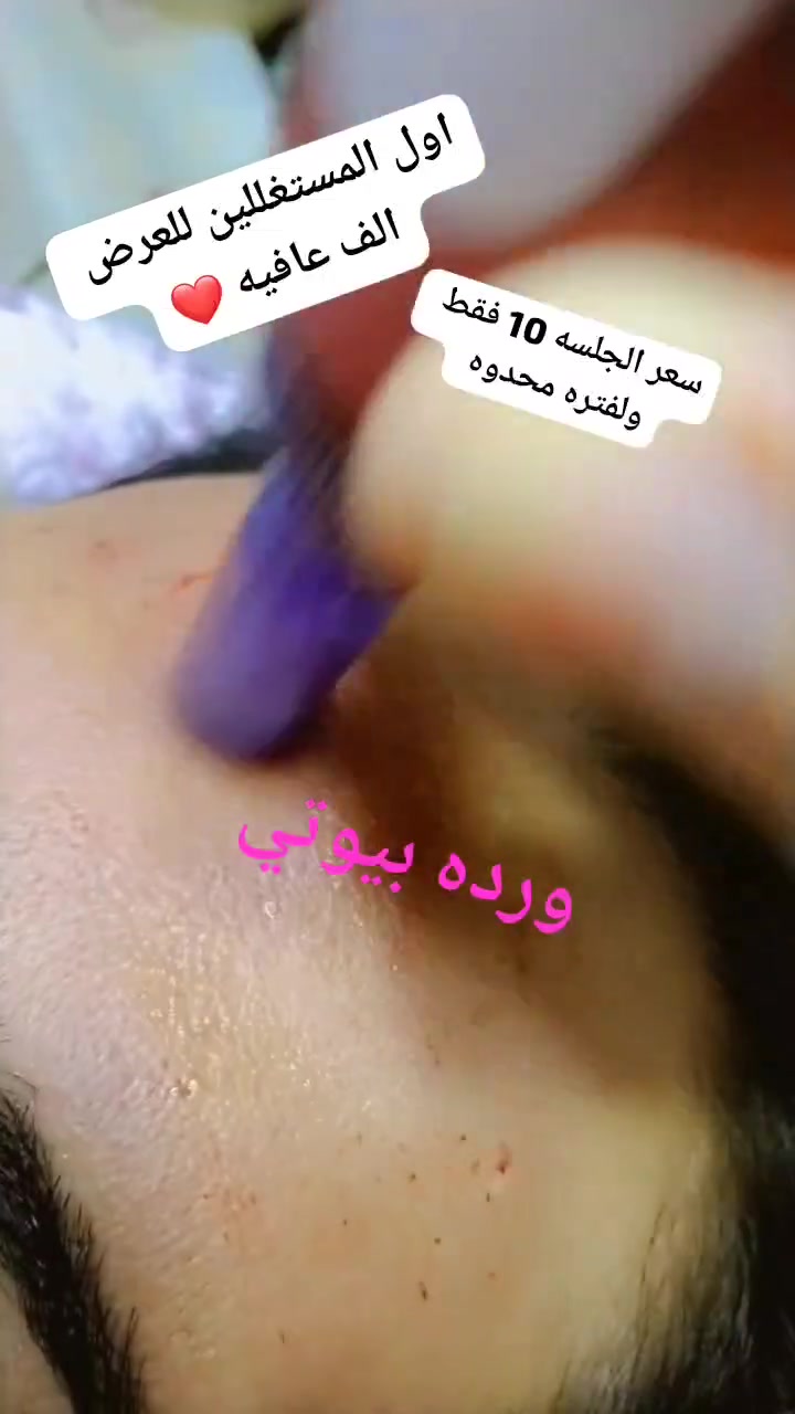 𝒲𝒶𝓇𝒹𝒶 𝐵𝑒𝒶𝓊𝓉𝓎 🎀 
🌷 ورده بيوتي 🌷 
الخطيب الزراعي شارع المولده الحمره شارع عيادات صحتي 
للحجز مراسله الصفحه الرئيسيه 
او مراسله الرقم واتساب ***********
فولو #فولومي #فولورز #اكسبلور_فولو #ضيفوني #الاكسبلور_فولو💕 #لايك_مي #بيع_لايكات #لايكاتكم_تسعدني #لايك_كومنت #تعليقات #تعليقاتكم_تسعدني😍 #تعليق #تعليقاتكم_تسعدني #متابعة_للبيج #ضيفو #اكسبلور #لقطة #لايك #دعم #تفاعل #لايكات #كومنت #كومنتات #اكسبلور
