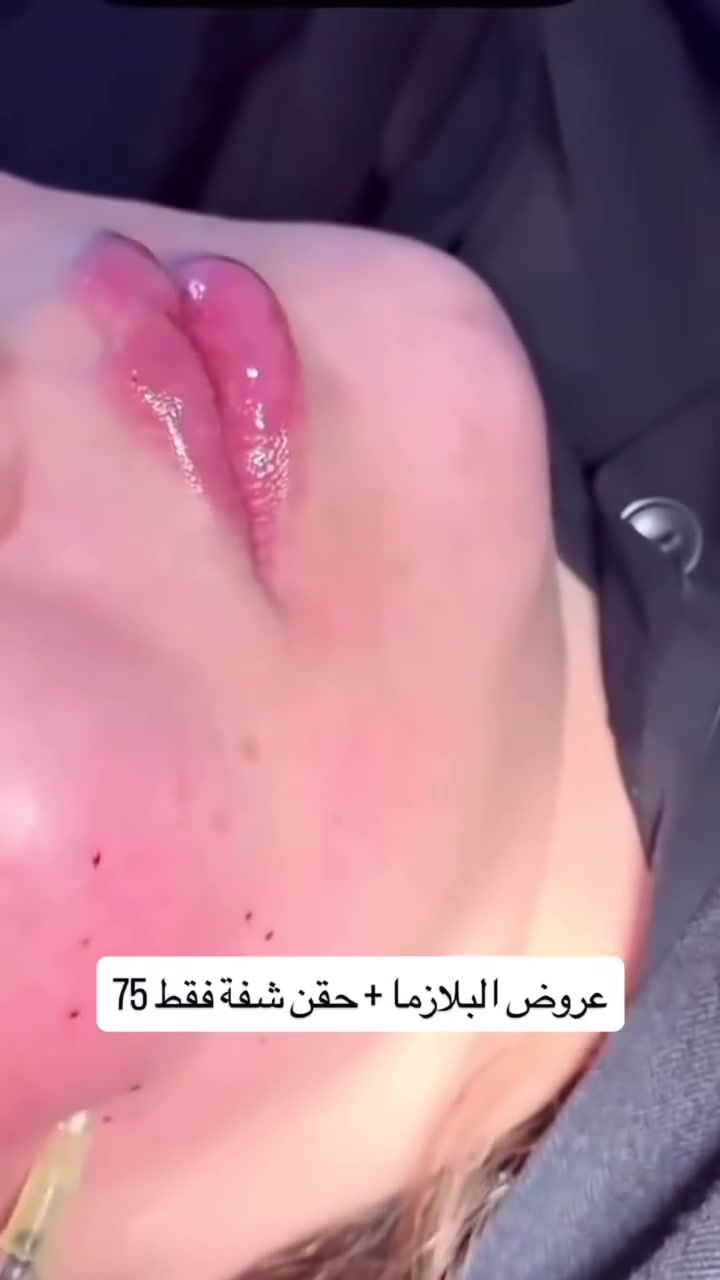 عروض دكتورة هبة
للتواصل ***********

