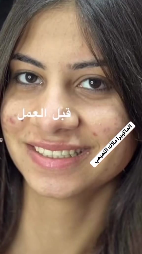 عرايسنا غير .. لان كل عروس الها بصمتها الخاصه
احلى عروض لملكاتنا الجميلات 

للحجز مراسلة الصفحة أو الأتصال على الرقم 
***********
موجود وات ساب انستا  7C5mk

