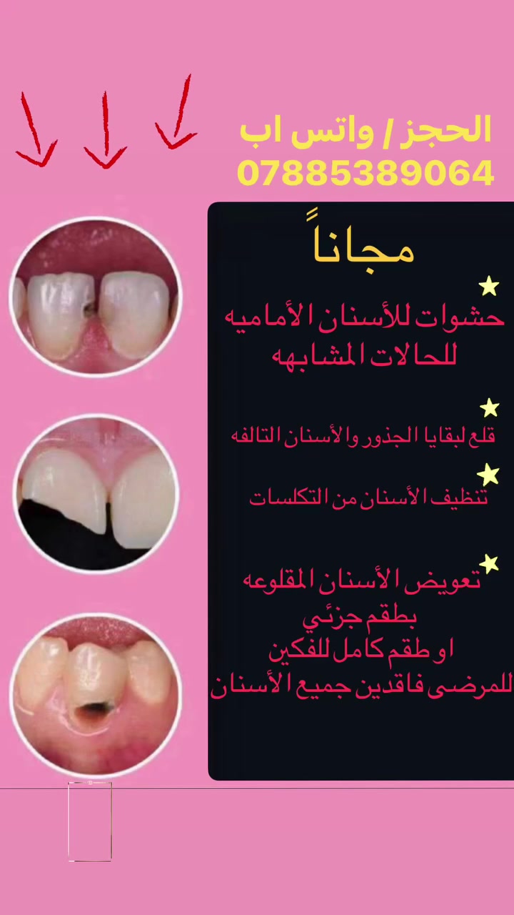 معالجه مجانيه بالكامل للحالات المذكوره فقط/للحجز واتس اب : ***********
