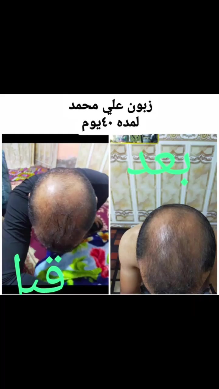 لتواصل والاستفسار ***********
