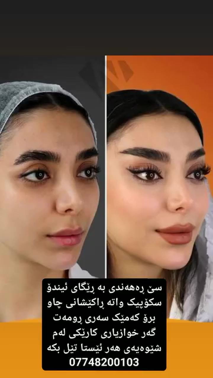 تکایە پێشەکی فۆڵۆی پەیج بکە ...
بۆ زانیاری دەربارەی کارەکانمان ئەتوانن پەیوەندی بکەن لە ڤایبەر یان لە واتس ئاپ یان،تلیگرام ***********
