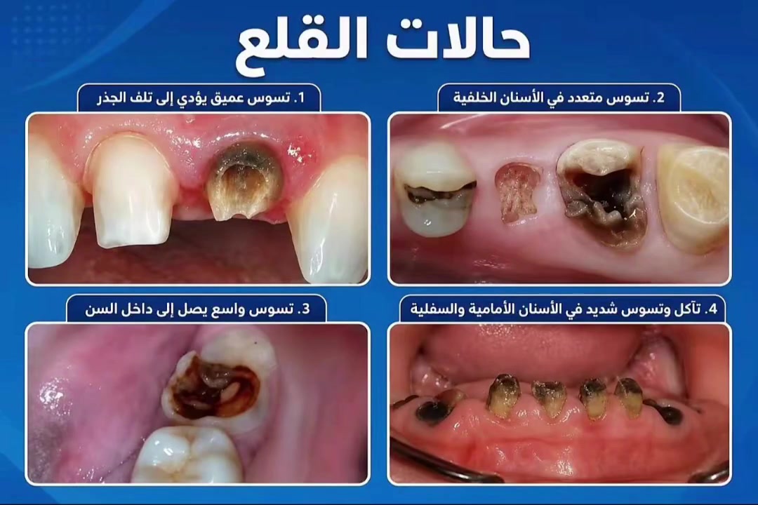 خدمات تجميل • إزالة • واتساب