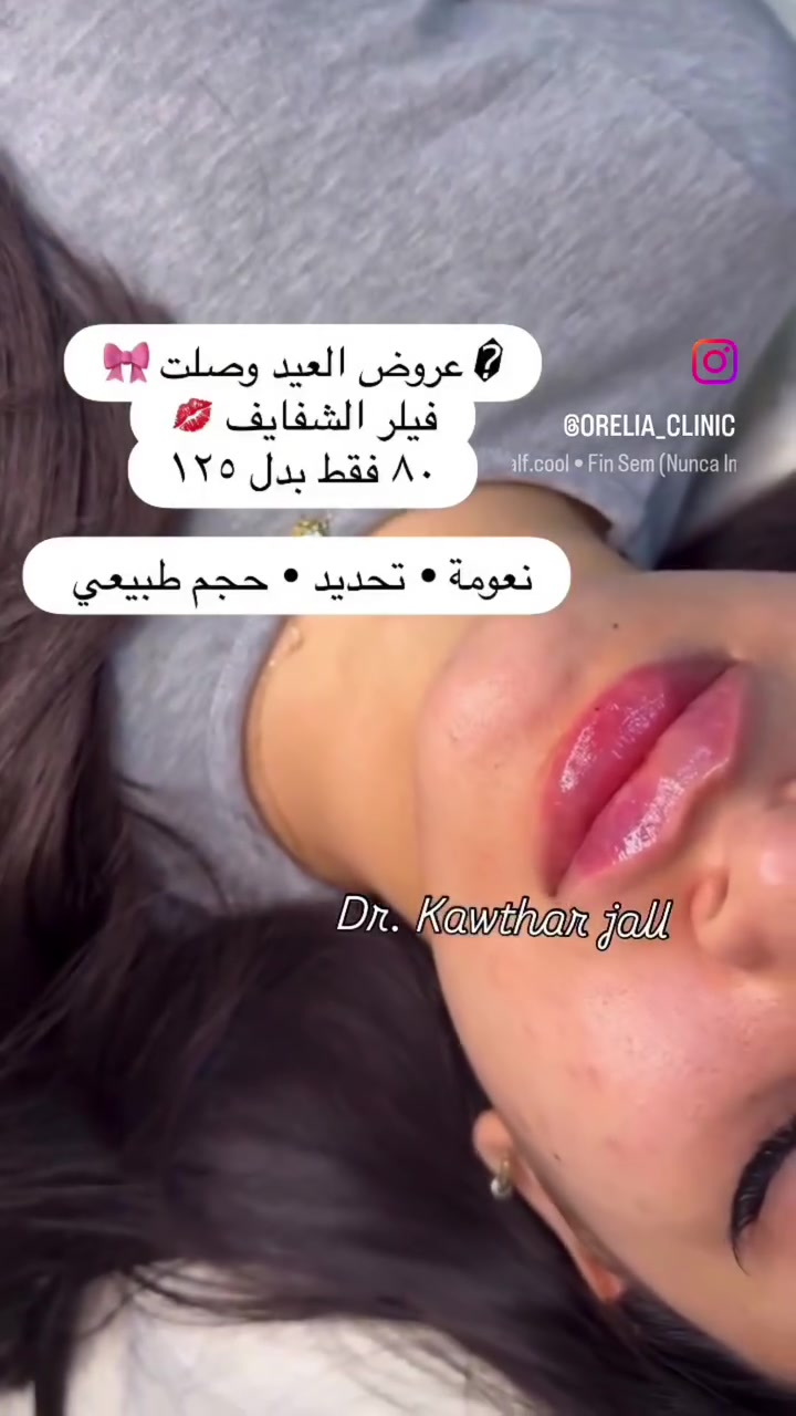 ​✨ ابتسامتك وجمالك… يكتملون في عيادة أوريليا! ✨
كل ما تحتاجه لابتسامة ساحرة وإطلالة مشرقة بمكان واحد، بإشراف أطباء اختصاص وبـ أنسب الأسعار ونتائج مضمونة 💎
​🦷 خدمات طب وتجميل الأسنان:
​ابتسامة هوليوود، تبييض ليزري، حشوات تجميلية، وزراعة وتقويم بأحدث الأجهزة وبدون ألم.
​💉 قسم التجميل اللاجراحي:
​حقن الفلر، البوتوكس، جلسات النضارة والبروفايلو لإطلالة طبيعية وشابة.
​📍 العنوان: بغداد - الغزالية - شارع البدالة - مجاور مكوى الغزالية
​📞 للحجز والاستفسار: *********** دكتورة كوثر 
​عيادة أوريليا.. لأنك تستحق الإطلالة الأفضل! ✨
