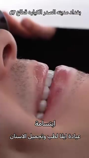 تجميل أسنان • زراعة أسنان • تقويم بالتقسيط