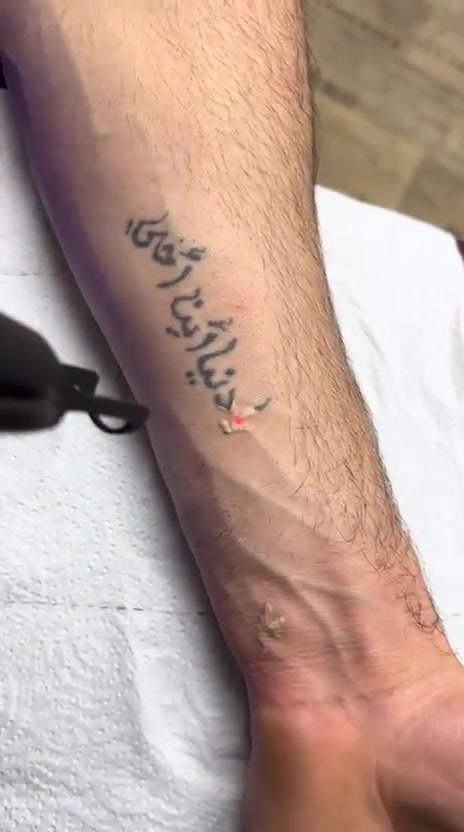 ازاله وشم داخل الصالون ونتائج روعه
كلا الجنسين
تقشير كاربوني 
توريد شفه 
ازاله تاتو
كوافير علي ✂️✂️
***********
