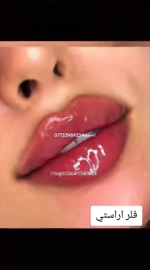 بمواد أمنه وأصلية 
 الحقن ورسم الشفاه حسب اختياركم 
ع يد خبيرة التجميل والمدربة الدولية
 الدكتورة ماجدة المنصور Jojo Alnabeel 
العنوان بغداد الحسينية مقابل السوق الكبير مجاور مرطبات العذراء
مجمع سما الحسينيه للطابق الثاني قسم التجميل والصالون ***********
