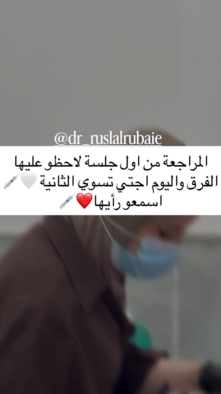 عروض شهر التاسع
مراجعاتي  الحلوات ورأيهم صوت وصوره ماشاءالله الفرق ديشوفو من اول الجلسات لان الاختيار يكون مو عشوائي كل مراجعة نختارلها مكس او ابرة خاصة لحالتها💉💗💗👏 وهو هذا الشغل الصح الي يخليكم تشوفون فرق من الجلسة الاولى 💉🍓

بخصوص العروض مراح تتكرر بعد ابداً لان اقوى عروض سويناهه 

خلال شهر التاسع واقبالكم عليه جداً عالي 💉👏

بخصوص كل المواد الجديدة الي تنزل داخل العياده تكدرون تتابعون صفحة الانستكرام 

https://www.instagram.com/p/DbWWdUhsNAt/?stkn=Z2EwenVjcm5rOXFu

او صفحتنا على الفيسبوك DrRusl Alrubaie

او مراسلتنا واتساب مسج فقط ***********
