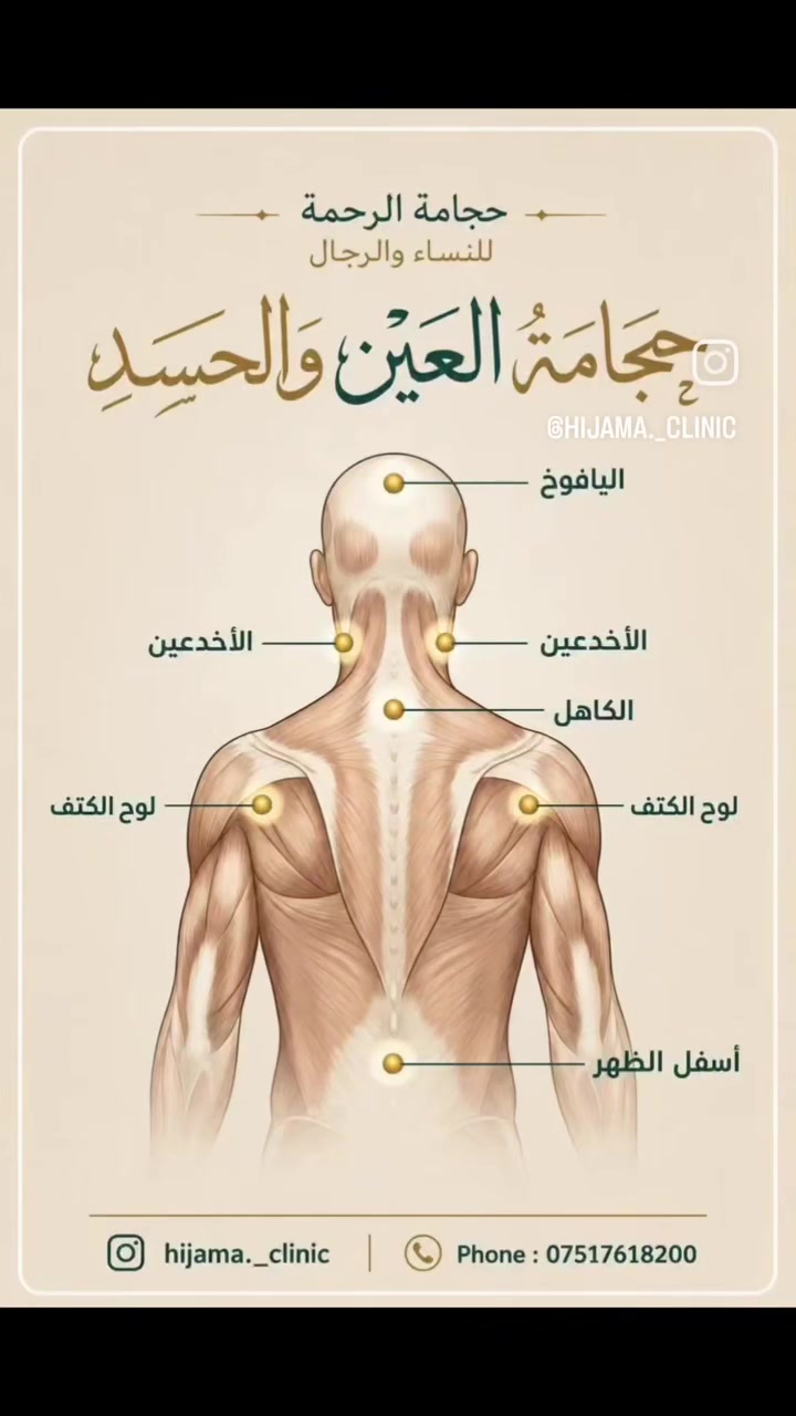 🌿 مواضع الحجامة للحسد والعين 🌿
ورد ذكر العين والحسد في القرآن والسنة، ومن أسباب التحصين: الرقية الشرعية والأذكار والدعاء 🤍
وتُستخدم الحجامة كطب تكميلي، للحجز والاستفسار التواصل عبر الخاص أو الإتصال على الرقم التاي
🤍 حجامة الرحمة للنساء والرجال
📱 hijama._clinic
☎️ ***********
