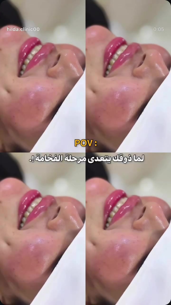 عشره سي فلر 150
بغداد تاجي ام العضام 

هديه ابره نضاره 
للتواصل ‭***********‬
