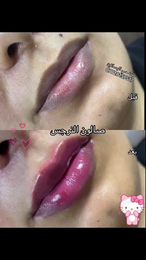 صالون النرجس • تنظيف قدم • حي البساتين