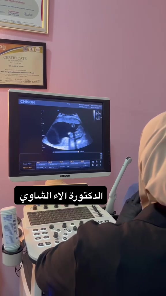 أجمل اللحظات تبدأ بصورة على السونار… 
وتنتهي بحلم صغير يكبر داخل القلب 💙

عيادة الدكتورة الاء الشاوي
نسائية • رعاية حوامل • فحص بالسونار 

عنوان العيادة: الزعفرانية شارع الربيع مقابل مركز التدريب المهني 
للحجز والاستفسار ***********
