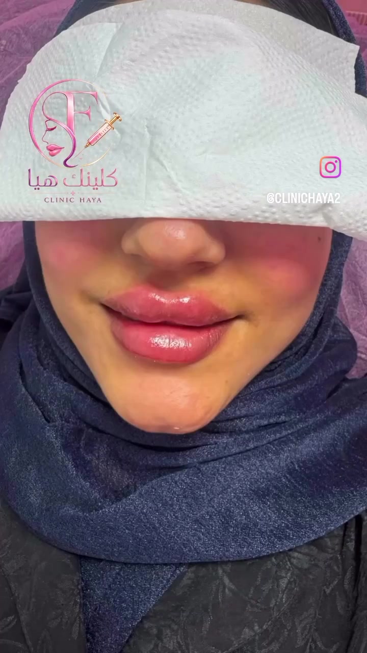 البياع تقاطع الشرطه الرابعه يم مطعم السديل ***********

