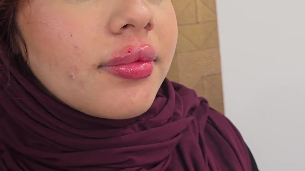 فلر إيطالي • سيسي ٥٠ • عيادة هيلدا
