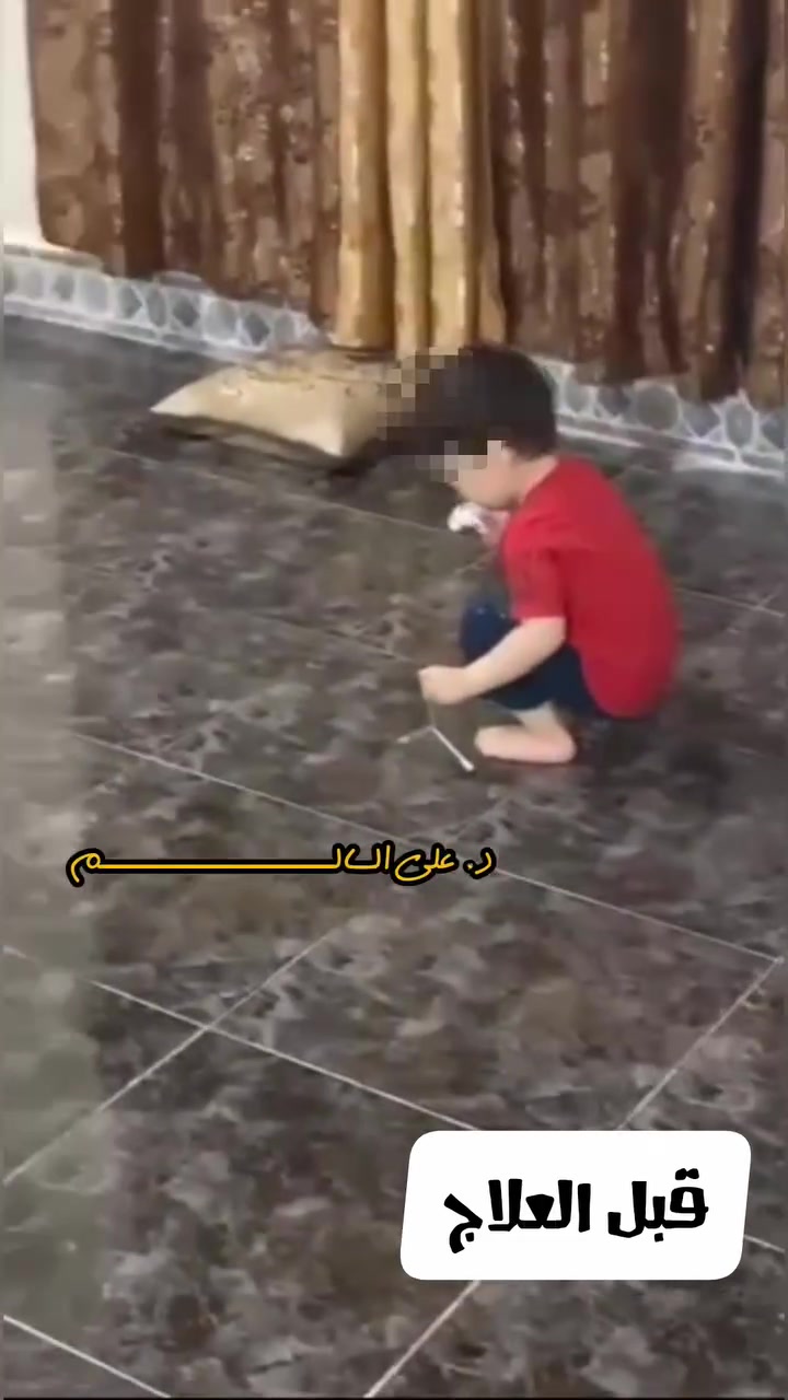 حالة تحسن كبيرة وقريبة جداً من الشفاء

الاسم: عباس فاضل محمد
العمر: 8 سنوات
المرحلة: 12
التشخيص: توحد متوسط

الطبيب المعالج:
د. علي السالم
بورد عراقي (دكتوراه)
اختصاص طب الجملة العصبية
العنوان: بغداد – السيدية – الشارع التجاري – داخل شارع إعدادية الصناعة
رقم الحجز: ***********

‏━━━━━━━━━━━

الحالة قبل العلاج:

- فرط حركة.
- تشتت انتباه شديد.
- صعوبة في التواصل البصري.
- ضعف شديد في النطق.

‏━━━━━━━━━━━

الحالة بعد العلاج:

- انخفاض واضح في فرط الحركة.
- تحسن كبير في الانتباه والتركيز.
- تطور جذري في النطق، من كلمة واحدة فقط إلى جمل وكلام طبيعي.
- تواصل بصري ممتاز.

‏━━━━━━━━━━━

هذه النتيجة تحققت بإشراف د. علي السالم الذي أثبت أن التشخيص الدقيق والمتابعة العلمية المنهجية قادران على إحداث فرق حقيقي في حياة أطفال التوحد.
