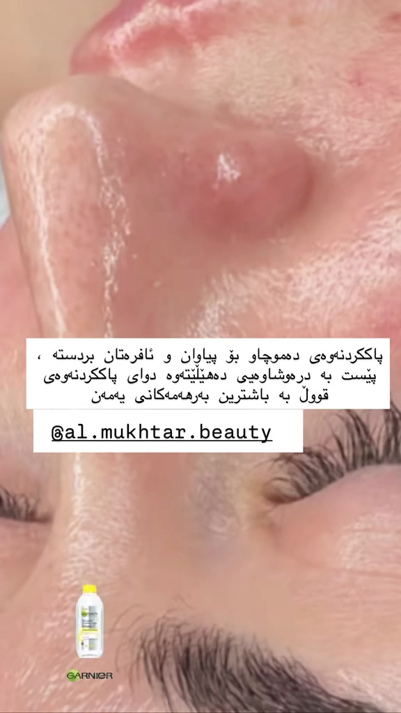 قسم ليرز تجميلية
متواجدين بالعيادة
الساعه٣ظهرا لحد ٨مساءا
عنوان طوز خورماتوو سوك حسن قوان
مجمع الشفاء الطبي
للحجز والاستفسار    ***********
