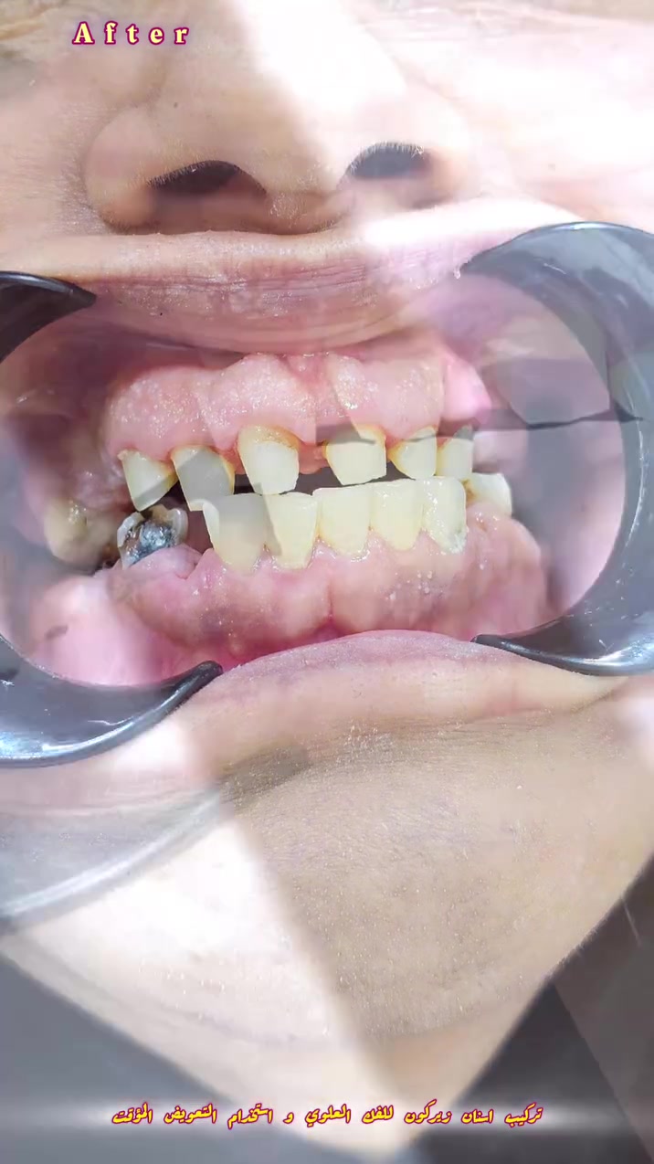 تجارب مراجعين • عيادة أسنان • الناصرية