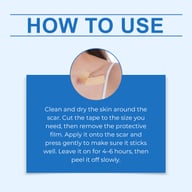 Silicone Scar Cover Patch | Thin, Breathable, Hyaluronic Acid — view 15