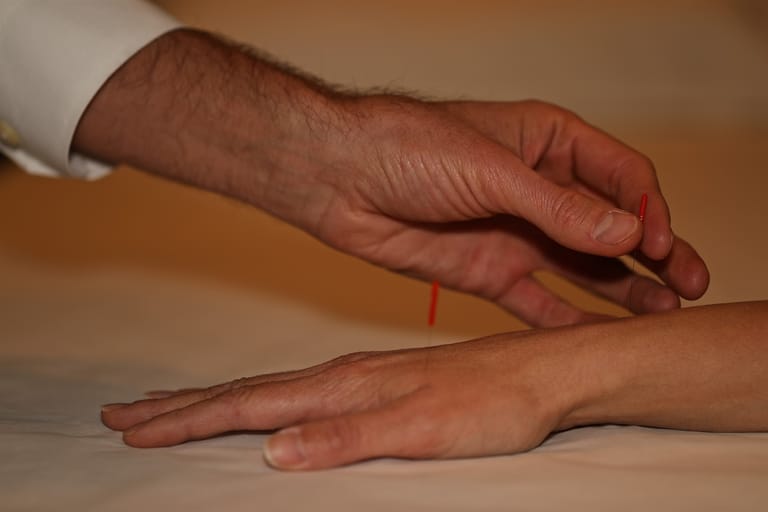 Colorado Natural Medicine + Acupuncture featured offerings