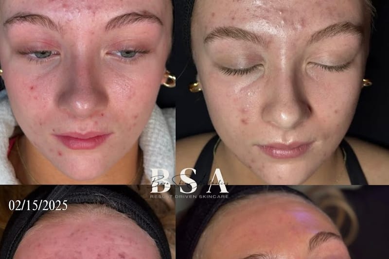 Bare Skin Aesthetics salon in Lone Tree, Colorado