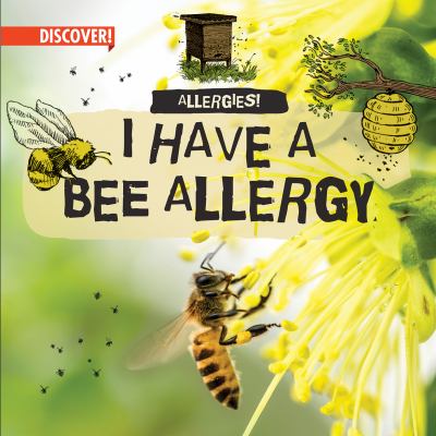 I Have A Bee Allergy
