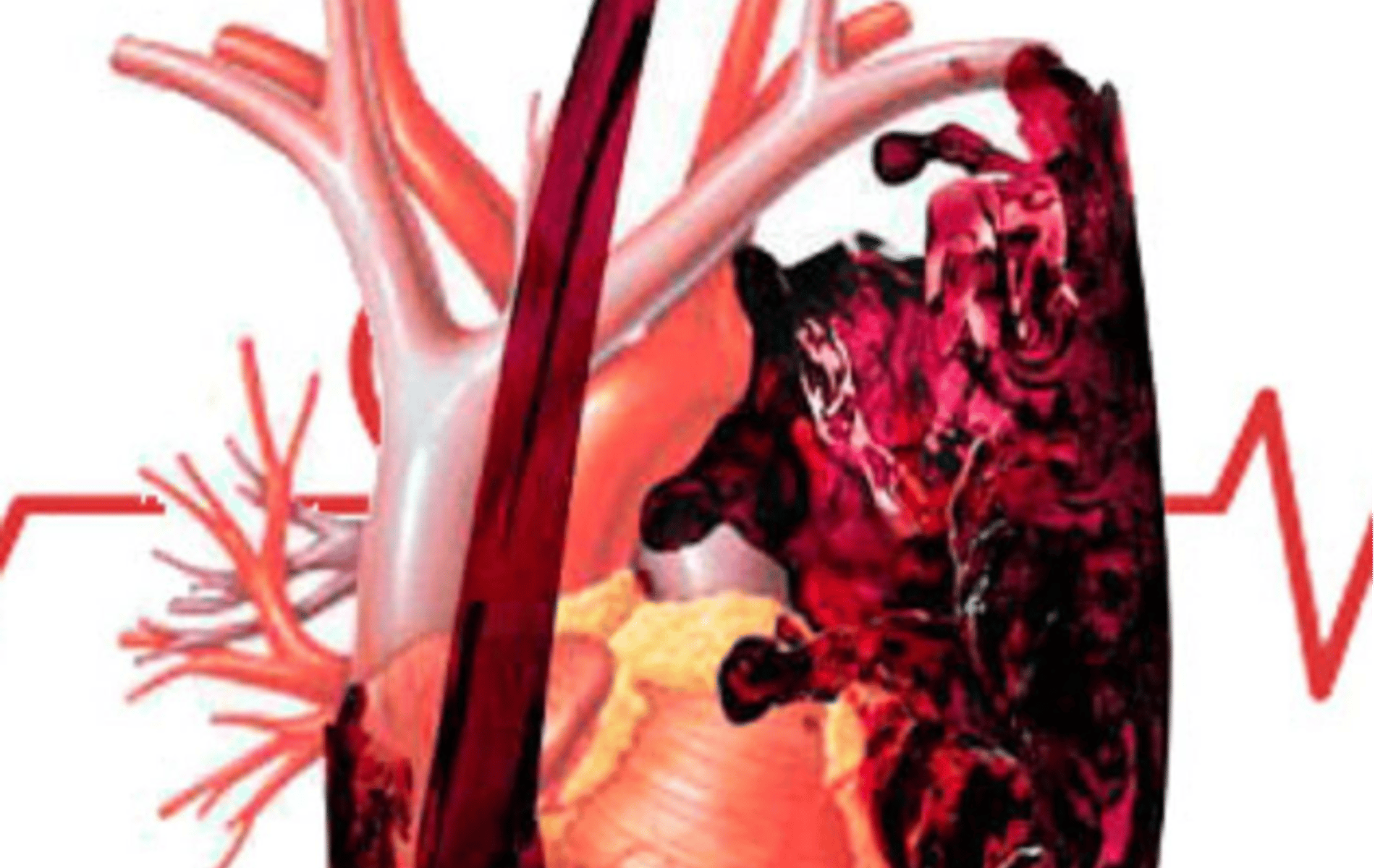 salud y vino: cómo influye en el colesterol