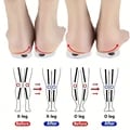 Orthopedic Silicone Gel Insoles with Magnet Massage Technology for Valgus Correction and O/X Leg Support - Unisex Design for Bunions, Flat Feet, and Alignment Issues - Shock Absorbing and Comfortable Foot Support