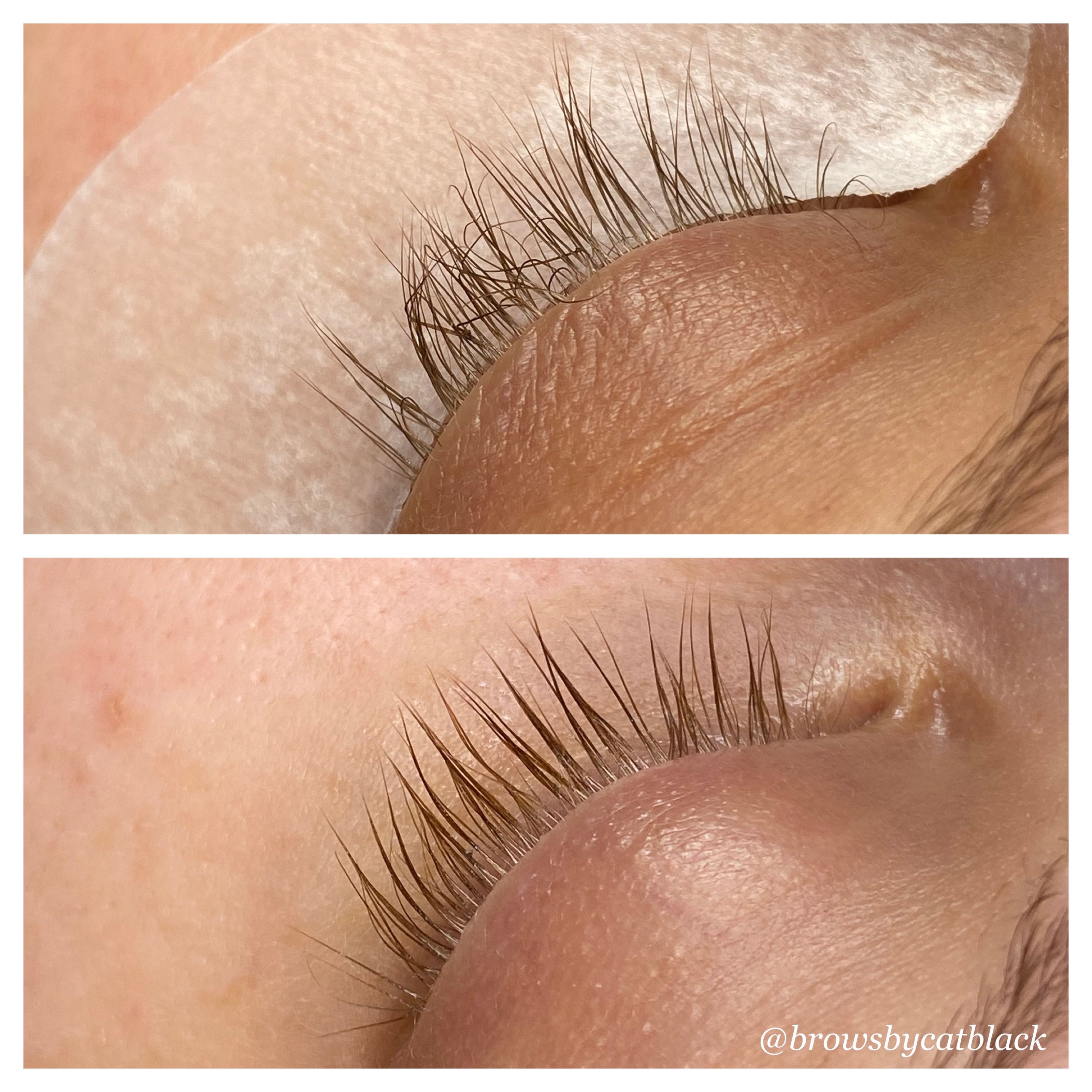Lash Lift Reversal