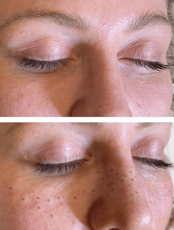 Faux Freckles (2nd Perfecting Appointment)