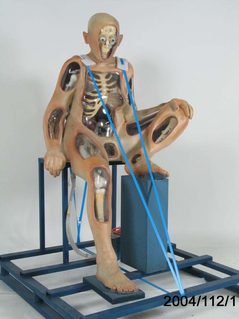 'Chocka Bits' display figure for surgical implants and prostheses