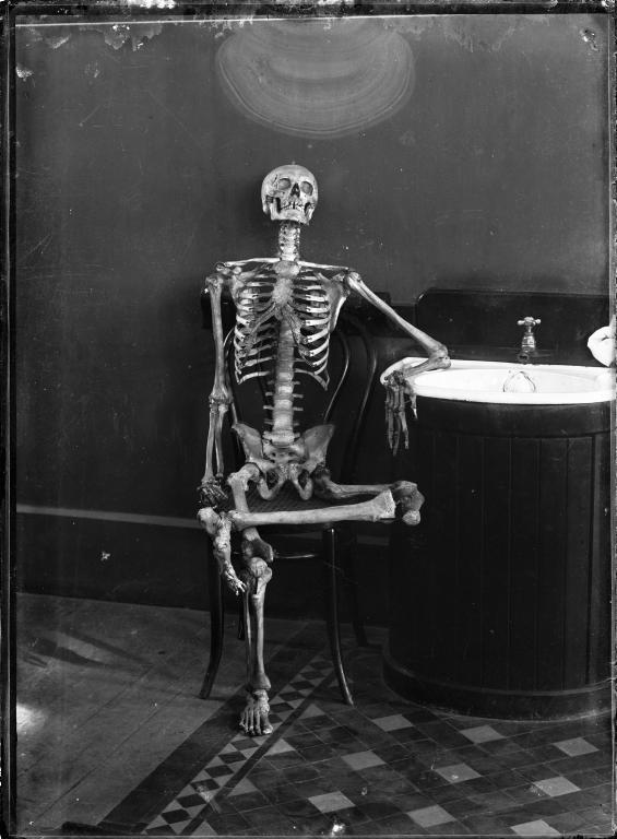 Glass plate negative, portrait of an articulated skeleton on a bentwood chair