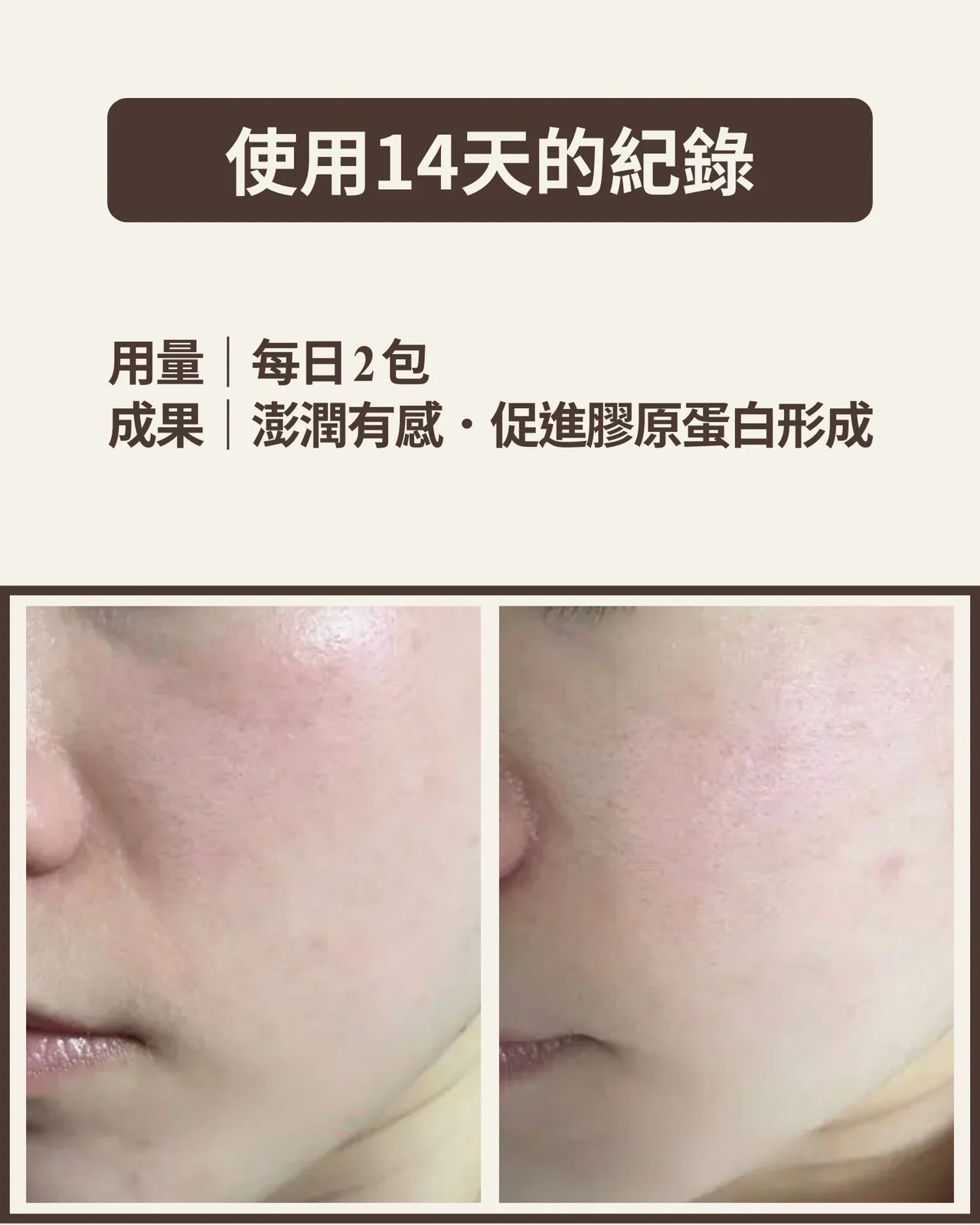 臉部膚況使用前後對比照，個人實際效果因體質而異